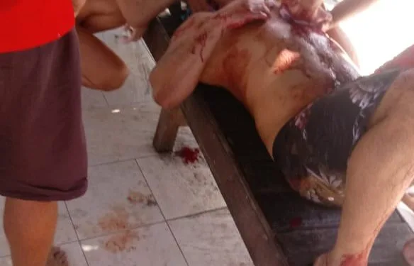 Pai esfaqueado após defender a filha passou por cirurgia e está em estado estável no RJ