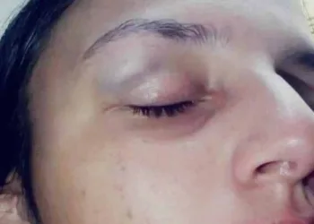 No RJ Homem bate na ex após pedir para eles reatarem e fazerem sexo