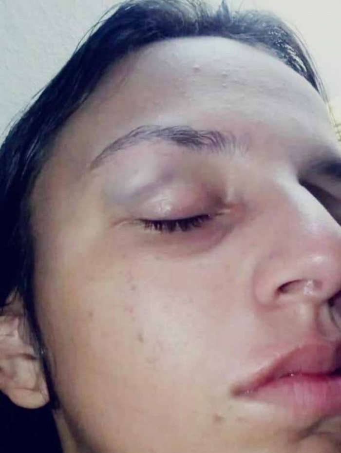 No RJ Homem bate na ex após pedir para eles reatarem e fazerem sexo