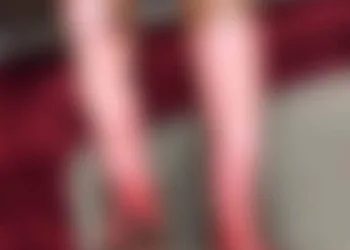 BOTIJÃO DE GÁS EXPLODE EM RESIDÊNCIA NA ZONA OESTE