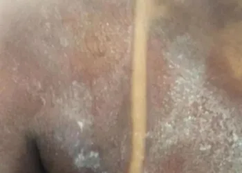 MARQUINHA PERFEITA!! JOVEM COMPRA BRONZEADOR PELO FACEBOOK E ESTÁ INTERNADA NA ZONA OESTE(FOTOS)