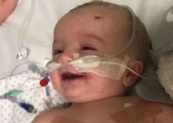 Após 7 meses em coma, bebê acorda e sorri para o pai