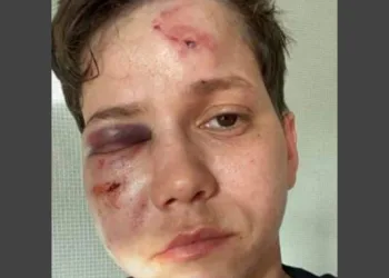 cuidado a próxima vítima de intolerância pode ser você!