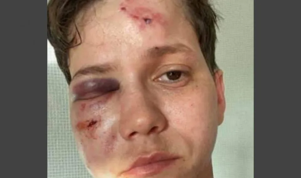 cuidado a próxima vítima de intolerância pode ser você!