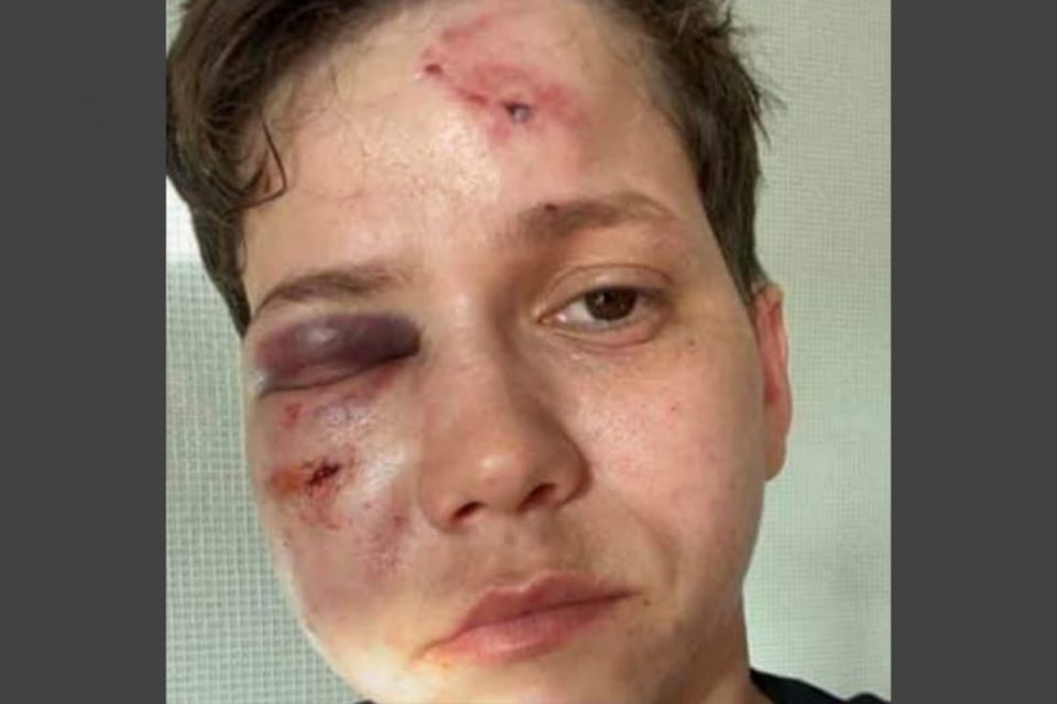 cuidado a próxima vítima de intolerância pode ser você!