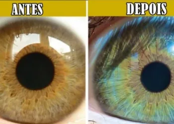 5 fatos que podem mudar a cor dos seus olhos e você nem imagina