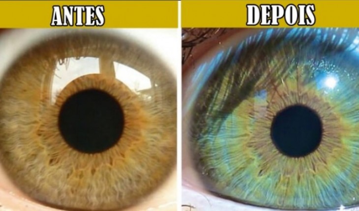 5 fatos que podem mudar a cor dos seus olhos e você nem imagina