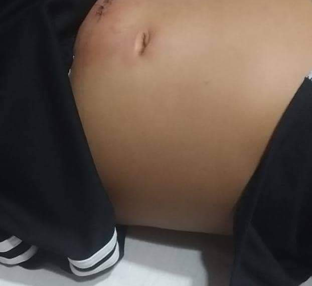 CRIANÇA PASSA SUFOCO EM HOSPITAL NA ZONA OESTE HÁ DIAS!!