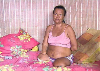 INSS NEGA BENEFÍCIO PARA MULHER SEM MÃOS E PERNAS PORQUE ELA NÃO PÔDE ASSINAR PAPEL