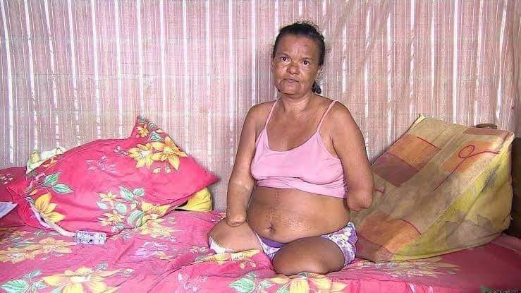 INSS NEGA BENEFÍCIO PARA MULHER SEM MÃOS E PERNAS PORQUE ELA NÃO PÔDE ASSINAR PAPEL
