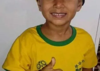 O MENINO BALEADO NA CABEÇA NO RJ TEVE UMA PEQUENA MELHORA