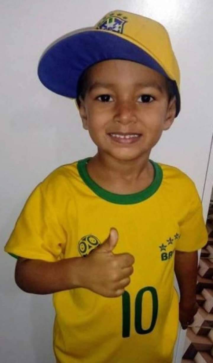 O MENINO BALEADO NA CABEÇA NO RJ TEVE UMA PEQUENA MELHORA