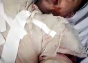 JOVEM ATEIA FOGO EM  EX NAMORADO NO RIO!!