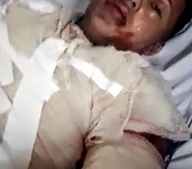 JOVEM ATEIA FOGO EM  EX NAMORADO NO RIO!!