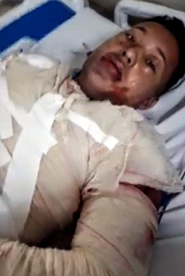 JOVEM ATEIA FOGO EM  EX NAMORADO NO RIO!!