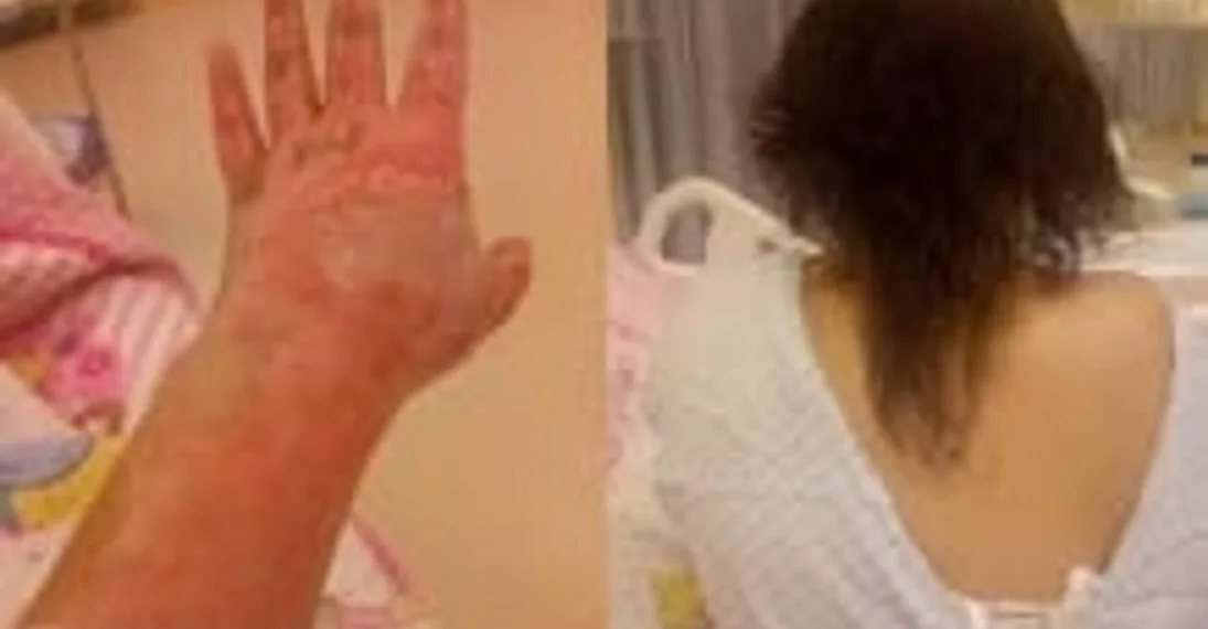 Homem é preso após jogar gasolina e atear fogo na enteada no RJ