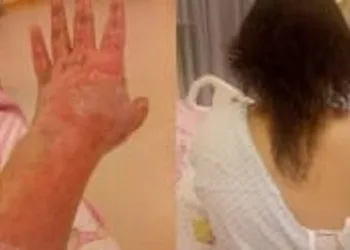 Homem é preso após jogar gasolina e atear fogo na enteada no RJ