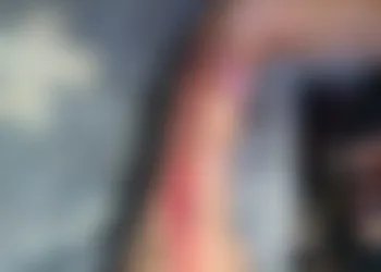 IDOSA TEM BRAÇO CORTADO NO HOSPITAL ROCHA FARIA EM CAMPO GRANDE