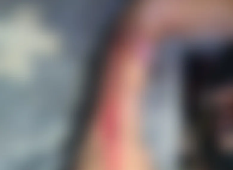 IDOSA TEM BRAÇO CORTADO NO HOSPITAL ROCHA FARIA EM CAMPO GRANDE