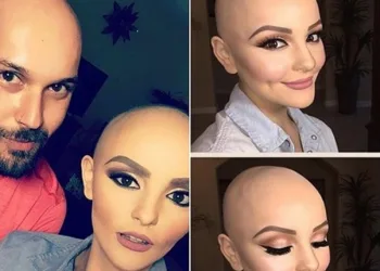 Garota com câncer vira princesa em ensaio e viraliza na internet