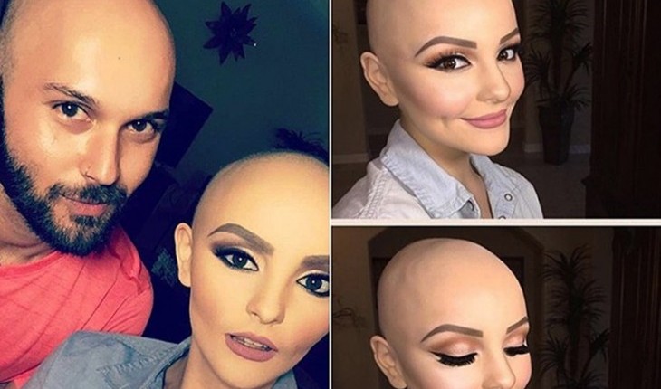 Garota com câncer vira princesa em ensaio e viraliza na internet