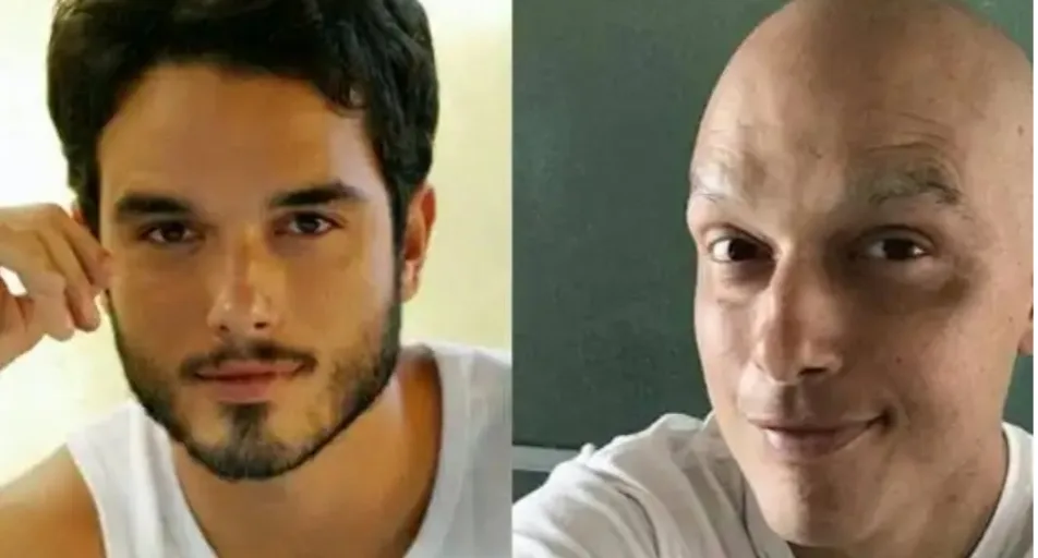 Com câncer,  ator Léo Rosa volta aos trabalhos em “amor de mãe “