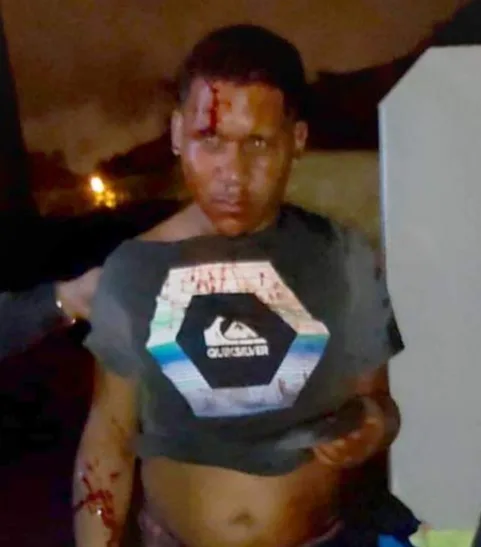 PRA CIMA DELES!! POLICIAIS PEGAM ASSALTANTE DO FRESCÃO NA AVENIDA BRASIL