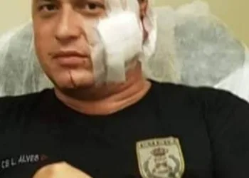 POLICIAL É BALEADO NUM CONFRONTO COM TRAFICANTES NA ZONA OESTE