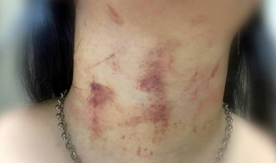 Jovem é enforcada pelo ex-companheiro durante série de agressões no Rio