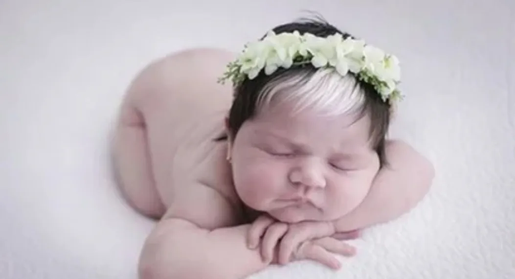 Bebê que viralizou por ter mecha branca cresceu e fez ensaio com o tema “Cruella