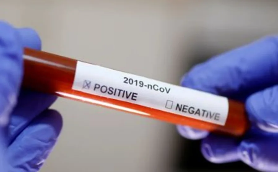 Fiocruz inicia distribuição de kits para diagnóstico do coronavírus