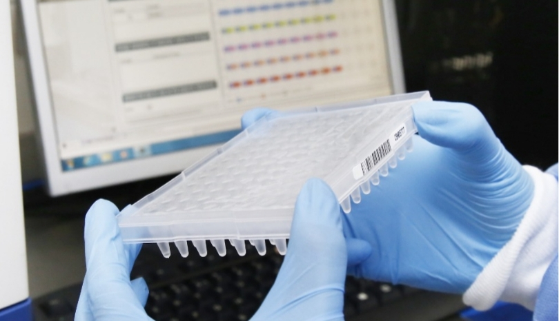 Coronavirus: 8 casos confirmados e 119 suspeitos no RJ, vejam os locais