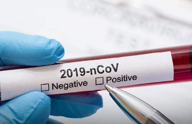 PRIMEIRO PACIENTE COM CORONAVÍRUS CONFIRMADO NO BRASIL ESTÁ CURADO…