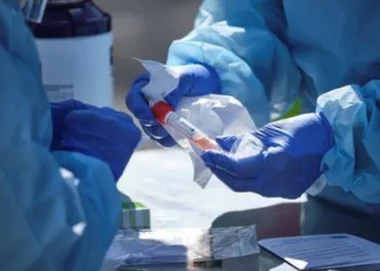 Coronavírus evolui de forma mais controlada no Brasil, diz estudo