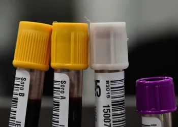 Hemorio inicia testes com plasma sanguíneo no tratamento de covid-19