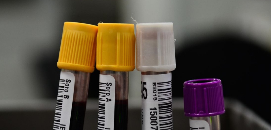 Hemorio inicia testes com plasma sanguíneo no tratamento de covid-19
