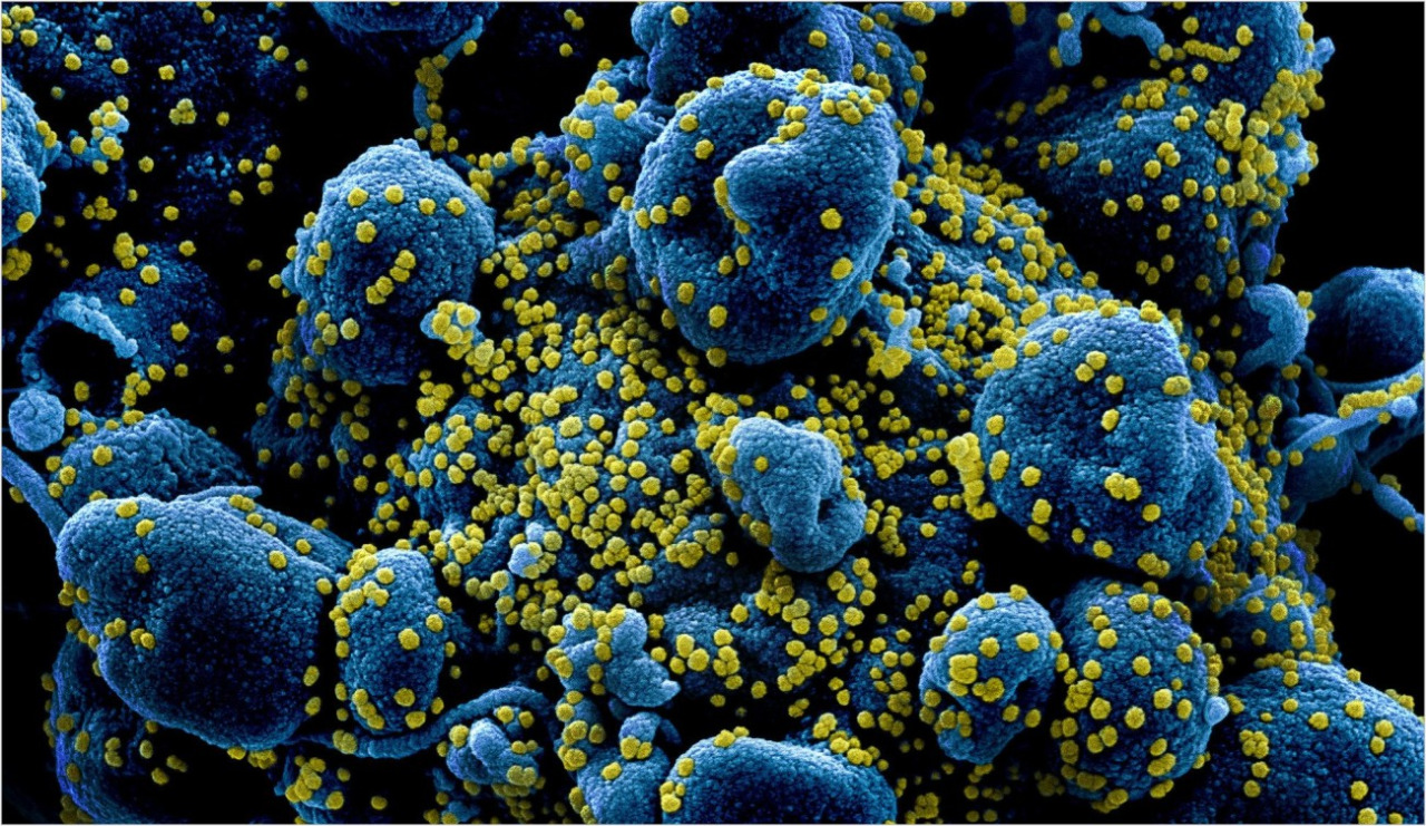 Covid-19: pesquisadores descobrem uma nova via de entrada do vírus no corpo humano