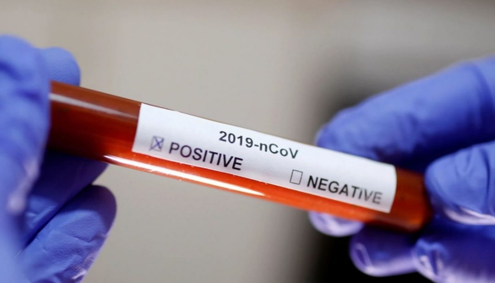 Prefeitura muda modelo de divulgações de mortes diárias por Covid-19 no Rio