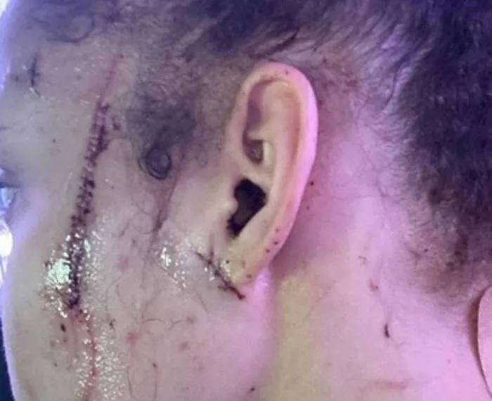 Sobrinha de Michael Jackson sofre ataque racista e é esfaqueada