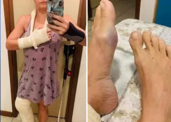 MÉDICA É AGREDIDA COVARDEMENTE POR 5 HOMENS NO RIO