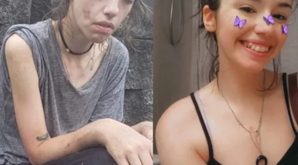 Jovem de 24 anos supera vício em drogas e se deslumbra com sua nova aparência.