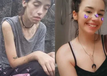 Jovem de 24 anos supera vício em drogas e se deslumbra com sua nova aparência.