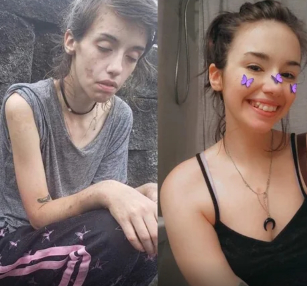 Jovem de 24 anos supera vício em drogas e se deslumbra com sua nova aparência.