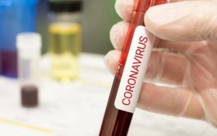 Pico da Covid-19 no Rio de Janeiro aconteceu entre abril e maio