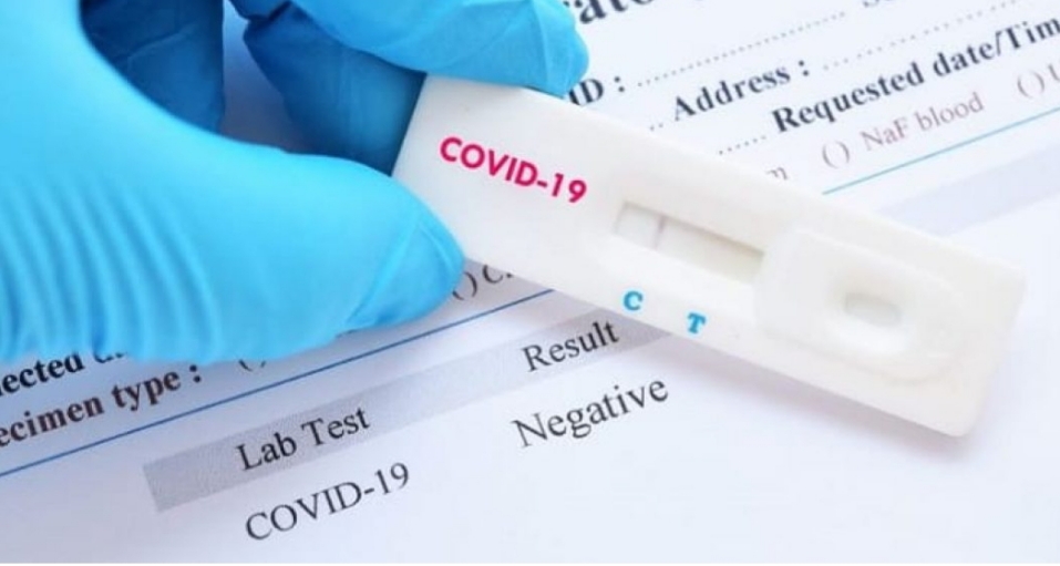 ANS torna obrigatória cobertura de teste de Covid-19 por planos de saúde