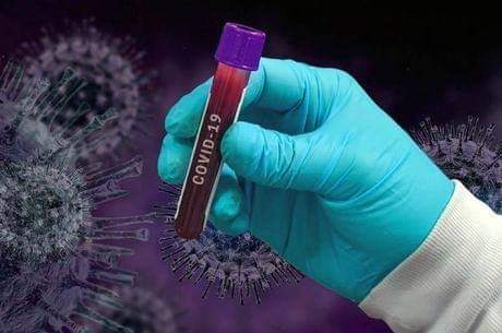 Sete óbitos pelo covid-19 em 24 horas em Campo Grande!!