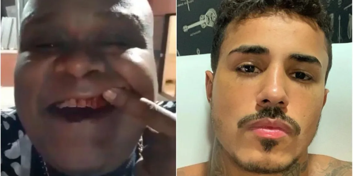 MC Gerex exibe boca sangrando e acusa Livinho de agressão
