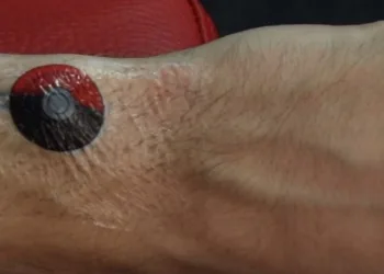 Google está trabalhando em ‘tatuagens sensíveis ao toque’