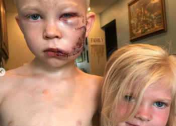 Capitão América vai enviar escudo para menino de 6 anos que salvou irmã de cão feroz