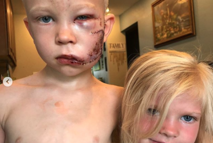 Capitão América vai enviar escudo para menino de 6 anos que salvou irmã de cão feroz